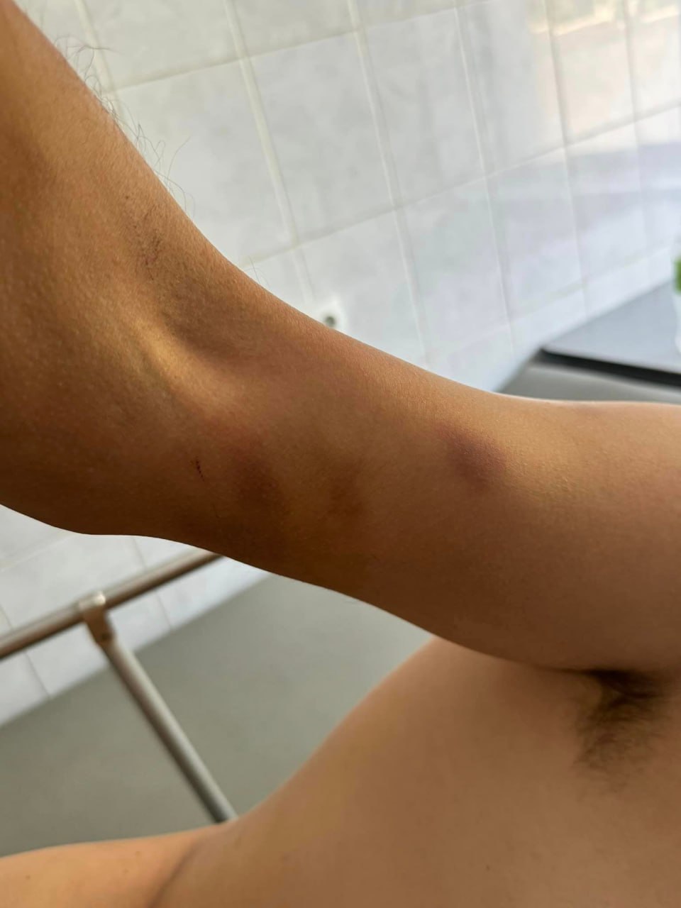 Фото (2) следов побоев. Источник - Телеграм